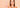Social Challenges of Women with Unwanted Facial Hairs