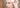 how to treat hirsutism in pcos naturally