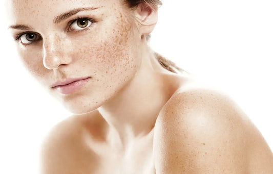 How to Reduce Freckles with HerbsAsia Infusion Beauty Cream Hydro-boost formula