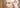 how to treat hirsutism in pcos naturally