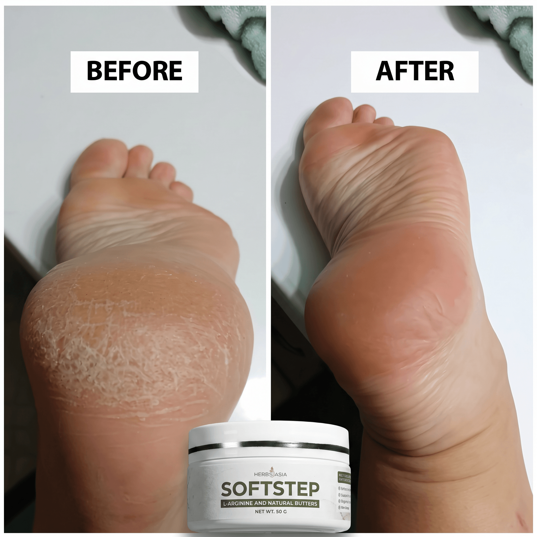 HerbsAsia Soft Step L-Arginine Foot Cream with Shea & Cocoa Butter, 50 g